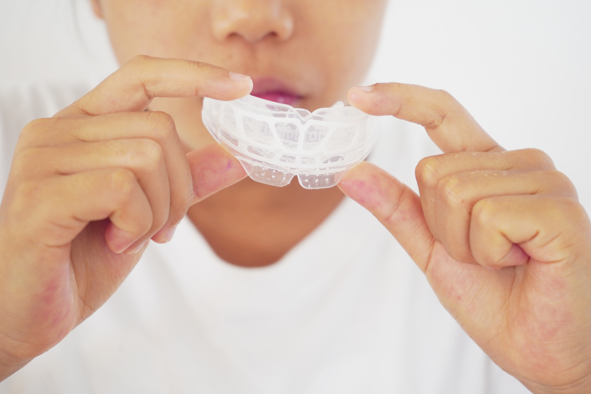 睡眠時無呼吸症候群用マウスピースの診療イメージ